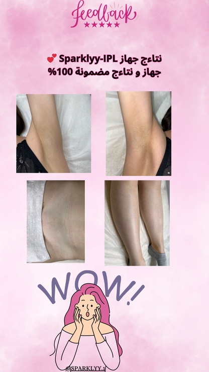 Sparklyy-IPL home laser hair removal device